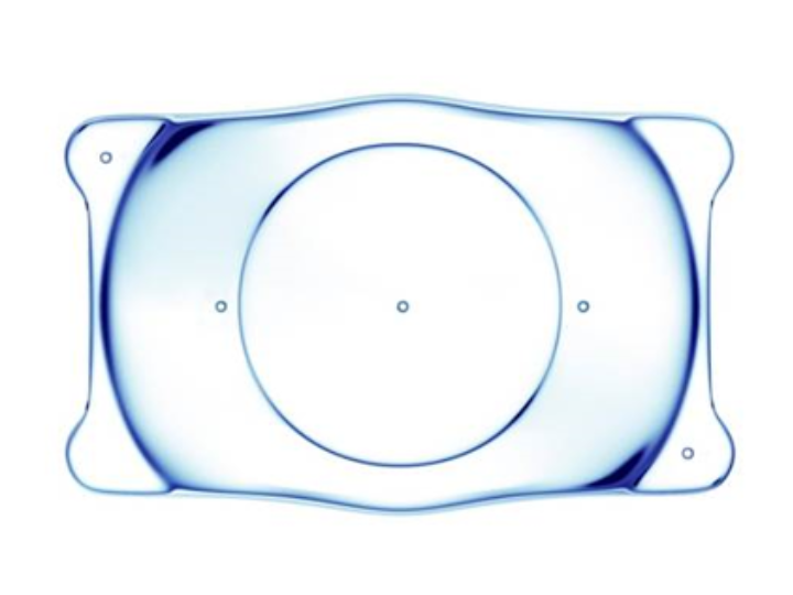 ICL(眼内コンタクトレンズ)